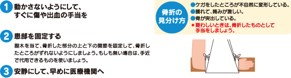 1.ưʤ褦ˤơ˽зμ2.ꤹ롦ڤơޤʬξȲδꤷơޤȤʤ褦ˤޤ礦⤷̵ϡѤǤΤȤޤ礦3.Ťˤơ˰ŵؤ